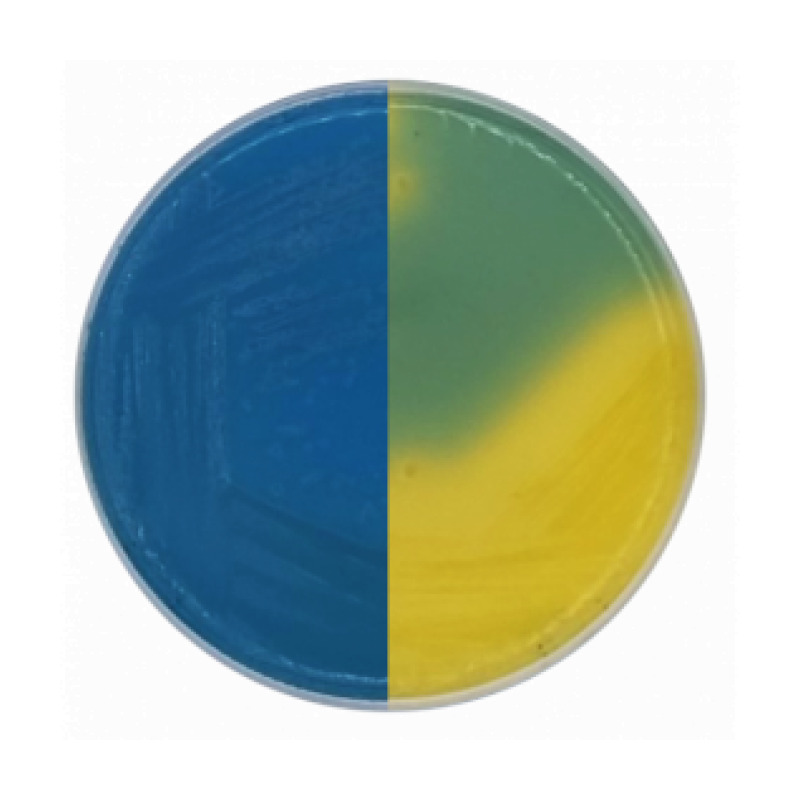 CLED Agar (Cystine Lactose Electrolyte Deficient)