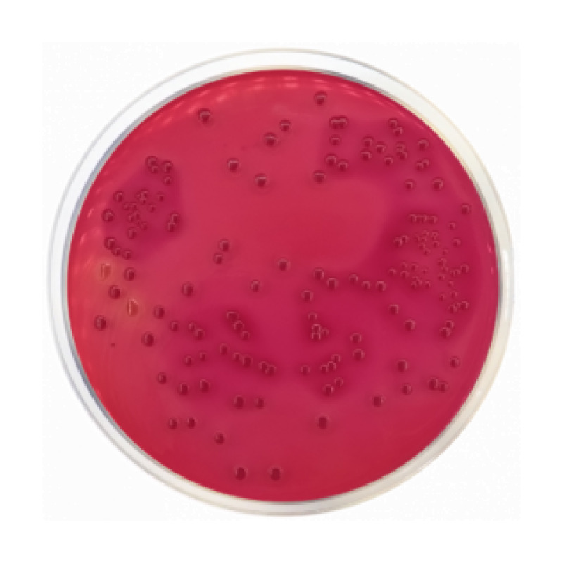 Desoxycholate Lactose Agar