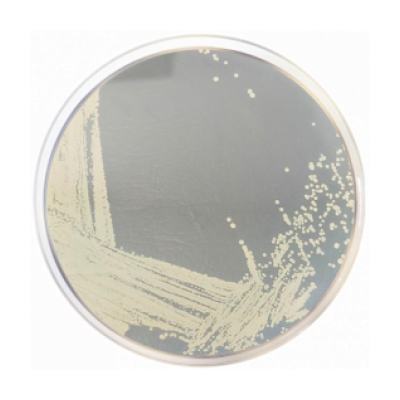 DNAse Test Agar (Deoxyribonuclease Activity)
