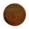 Eosin Methylene Blue Agar (EMB)