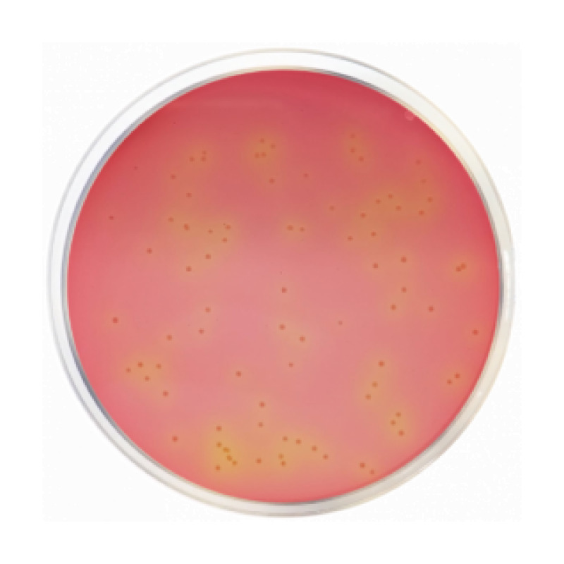 DCLS Agar (Desoxycholate, Citrate, Lactose, Sucrose)