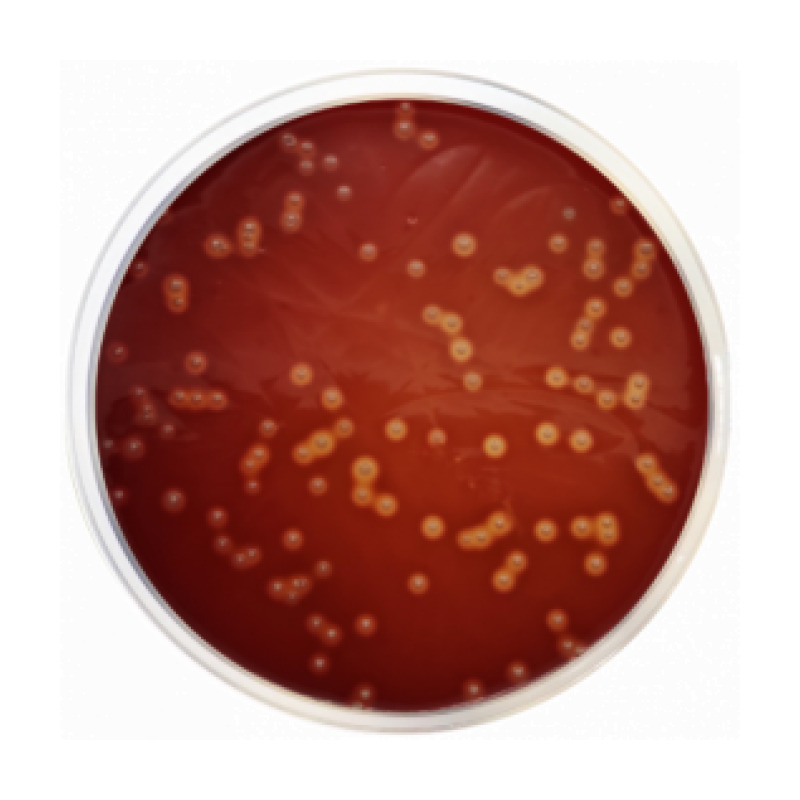 Brain Heart Infusion Agar (BHI Agar)