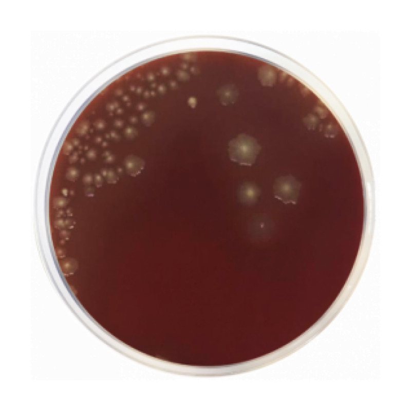 Schaedler Agar
