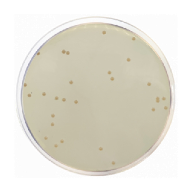Iron Agar (Lyngby)