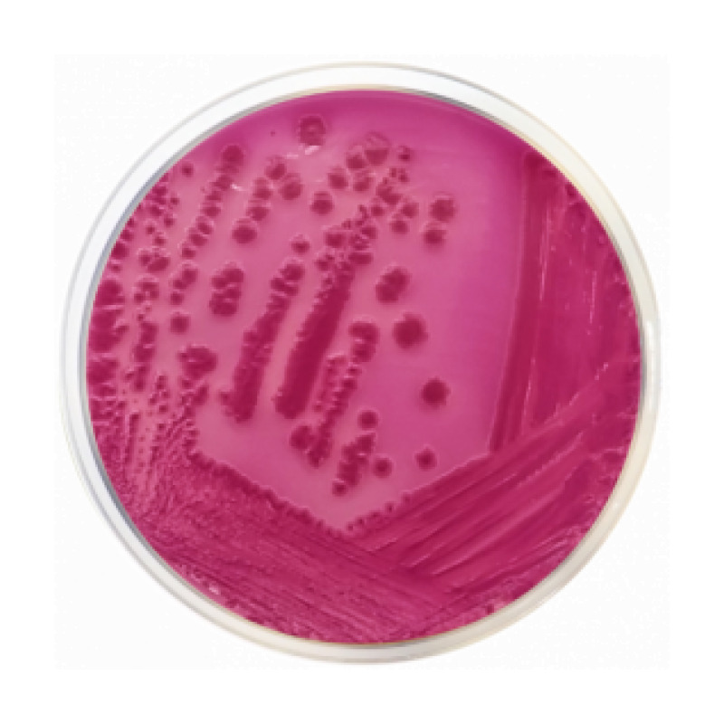 Violet Red Bile Agar with Lactose (VRBL) ISO