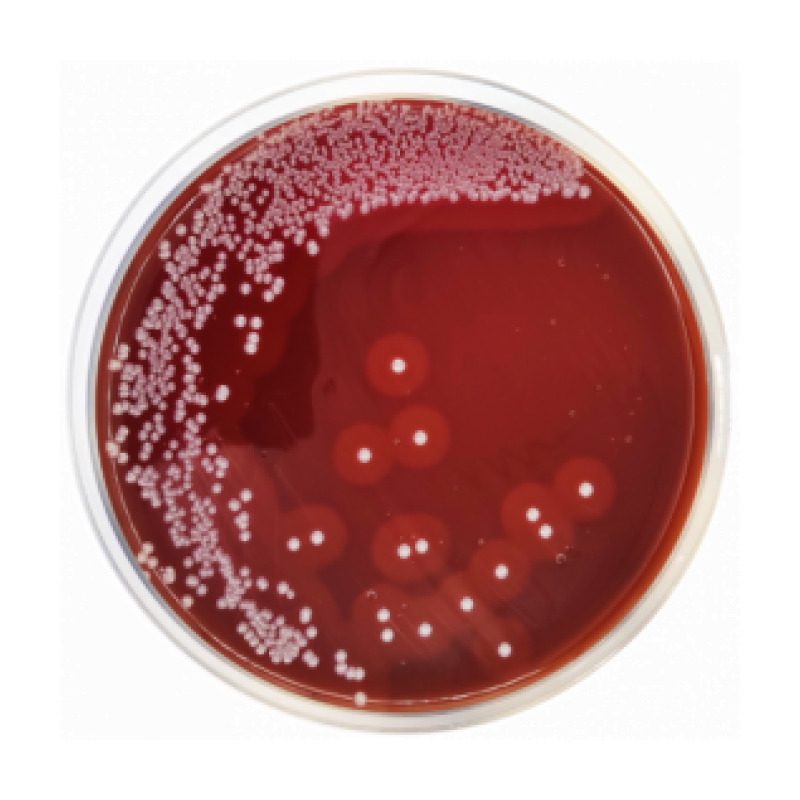GC Agar Base