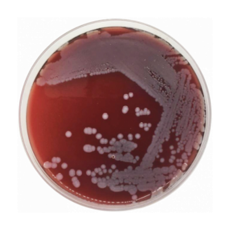 Blood Agar Base