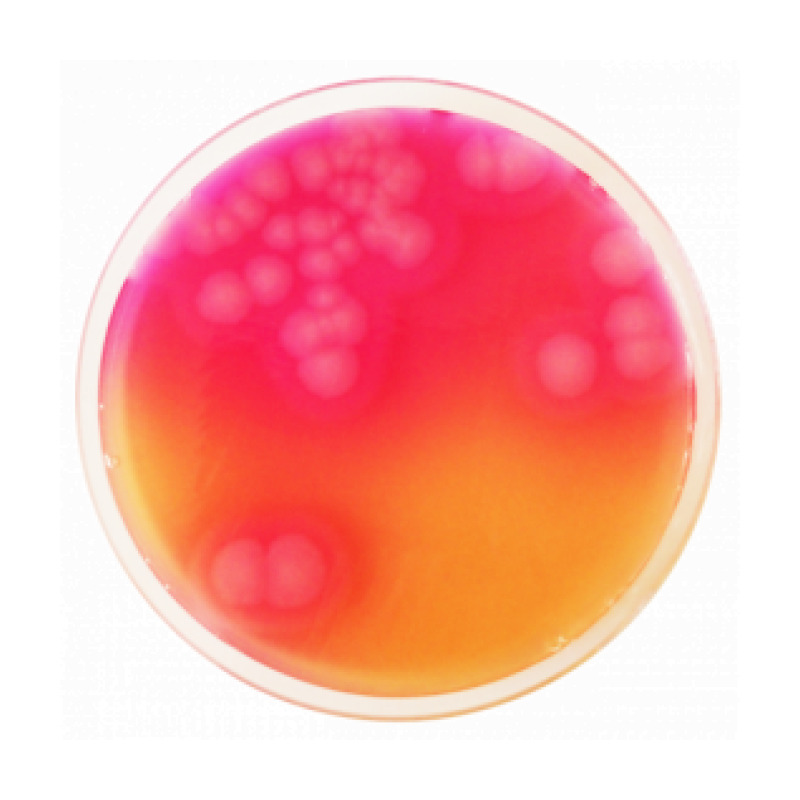 Bacillus Cereus Selective Agar Base (MYP)