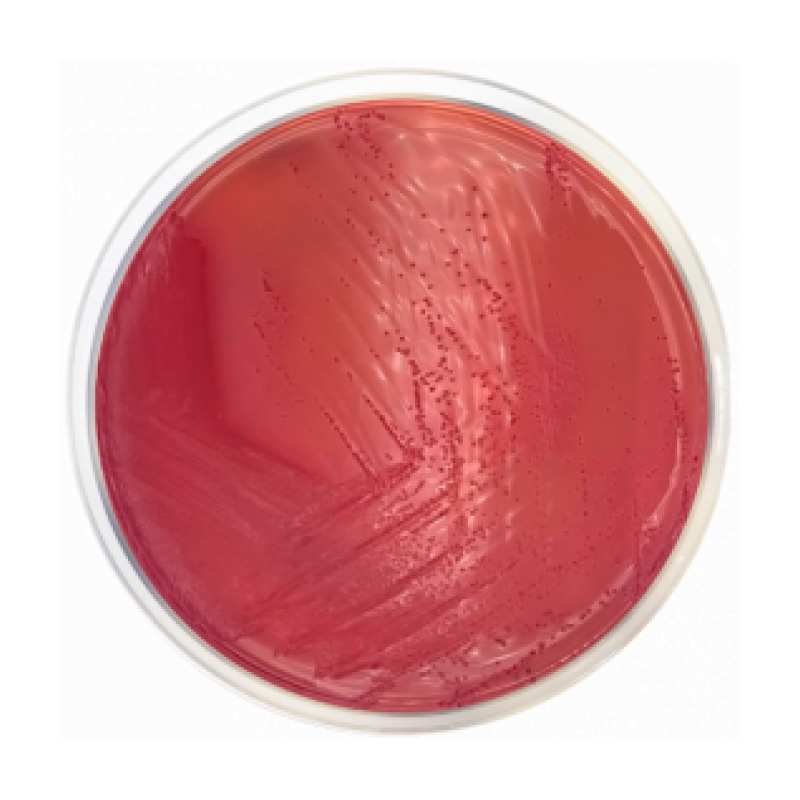 Yersinia Selective Agar Base (CIN) ISO