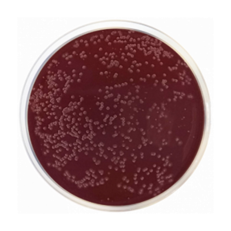 Campylobacter Agar Base (Preston)
