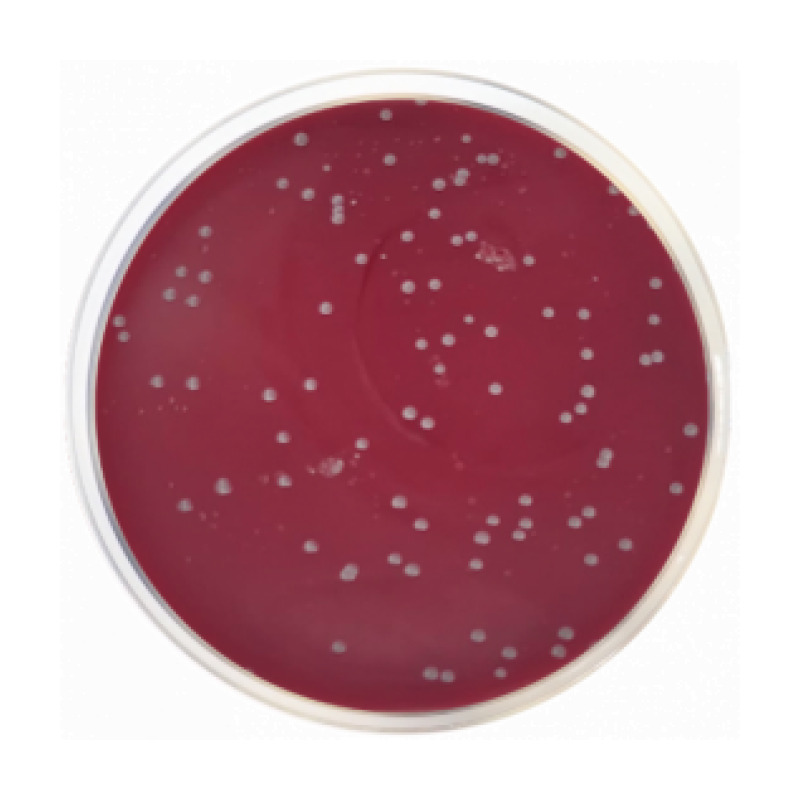 Columbia CNA Agar Base