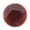 Tryptose Blood Agar Base