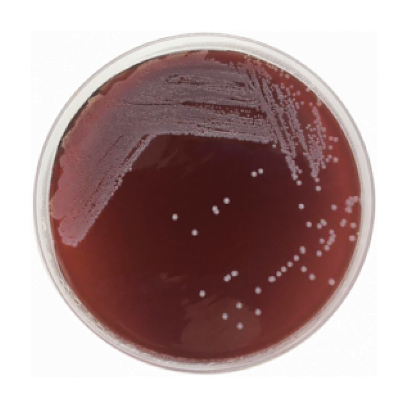 Tryptose Blood Agar Base