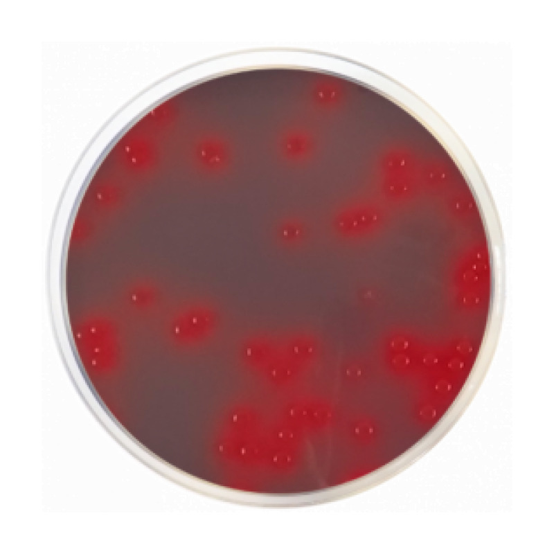 CLED Agar with Andrade´s Indicator