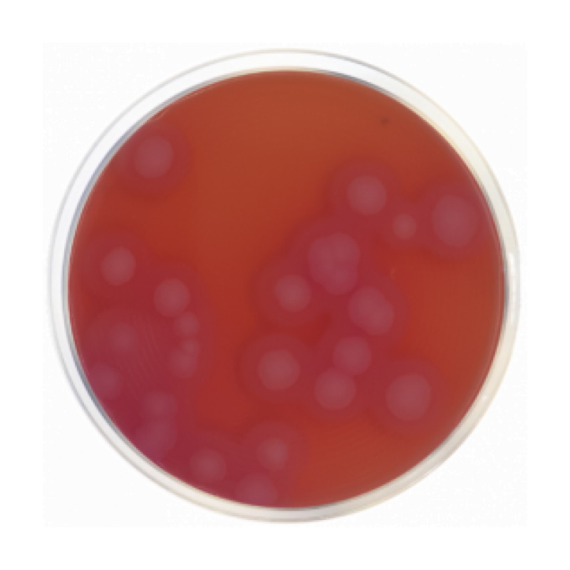 Bacillus Cereus Selective Agar Base (MYP) ISO