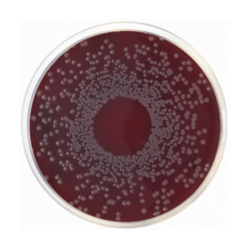 Trypticasein Soy Agar (TSA) Nº2